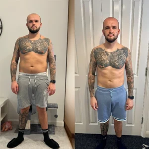 before and after 3-1